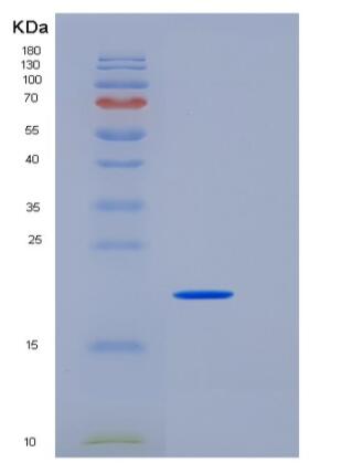 Recombinant Mouse Peroxiredoxin 1 / PRDX1 Protein (His tag)