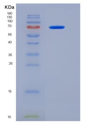 Recombinant Human MTSS1 Protein (aa1-250, His & MBP tag)