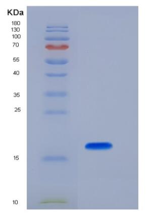 Recombinant Mouse Peroxiredoxin 5 / PRDX5 Protein (His tag)