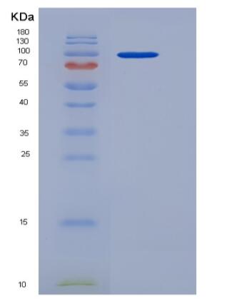 Recombinant Human AGO3 / Argonaute 3 / EIF2C3 Protein (His tag)