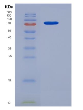 Recombinant Human HDAC3 / Histone deacetylase 3 Protein (His & GST tag)