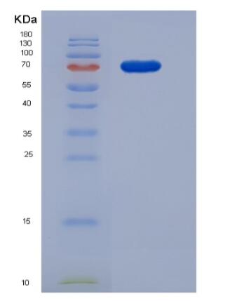 Recombinant Human Coagulation Factor XIII B chain / F13B Protein (His tag)