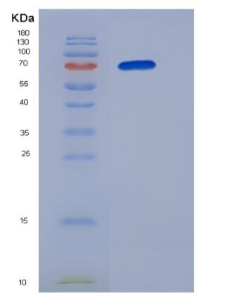 Recombinant Human B3GNT2 Protein (Fc tag)