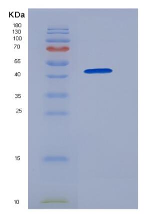 Recombinant Human GOLM1 / GP73 Protein (His tag)