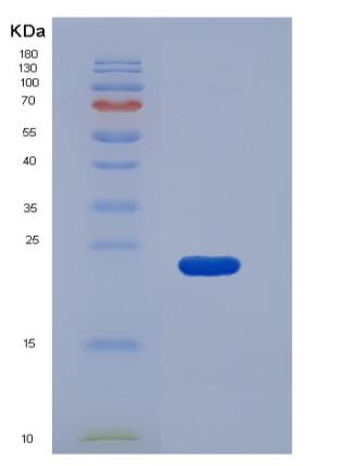 Recombinant Mouse Epcr / PROCR Protein (His tag)