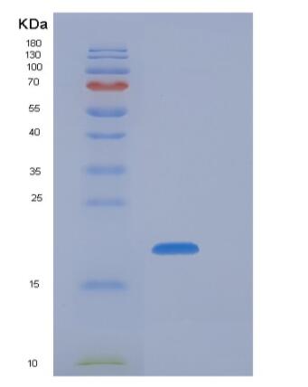 Recombinant Mouse NKG2A / NKG2 / CD159A / KLRC1 Protein (His tag)