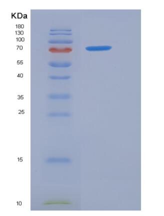 Recombinant Rat PCSK9 / NARC1 Protein (His tag)