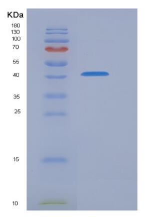 Recombinant Human PRMT6 / HRMT1L6 Protein (His & FLAG tag)