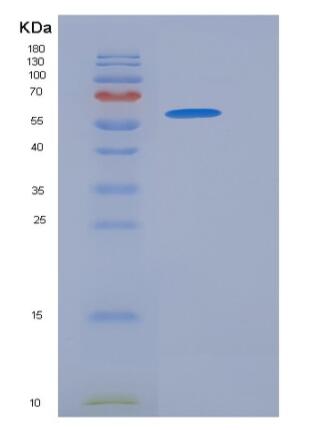 Recombinant Human CD93 / C1QR1 Protein (His tag)