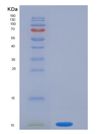 Recombinant Human S100P / S100E Protein