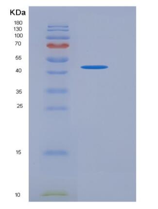 Recombinant Human NEIL1 Protein (His tag)