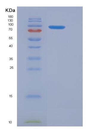 Recombinant Mouse GAD65 / GAD2 Protein (His & GST tag)