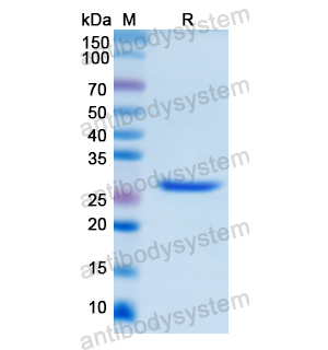 Recombinant Human UCHL1, N-His