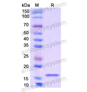 Recombinant Human CGB3, N-His