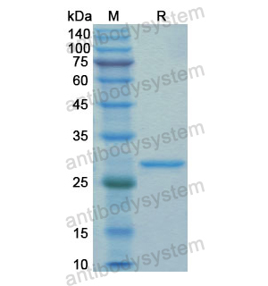 Recombinant Human GZMB, N-His