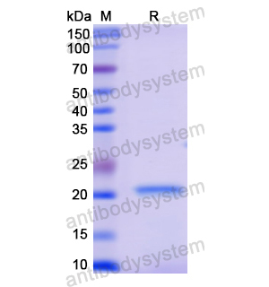 Recombinant Human GAA, N-His