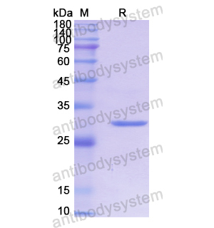 Recombinant Human CYP2D6, N-His