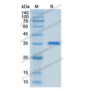 Recombinant Human MAPT/Tau/PHF-tau, N-His