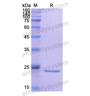 Recombinant Human TFPI, N-His