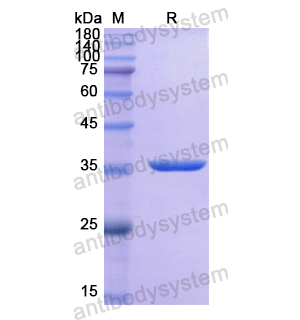 Recombinant Human ALPG, N-His