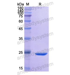 Recombinant Human CD117/KIT, N-His