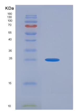 Recombinant Human A33 Protein (His Tag)