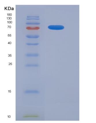 Recombinant Human CD93 / C1QR1 Protein (Fc tag)