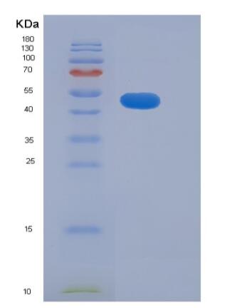 Recombinant Human ADAM15 Protein (His tag)