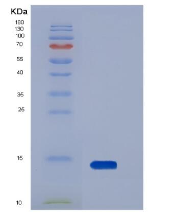 Recombinant Human AgRP / AGRP Protein (His tag)