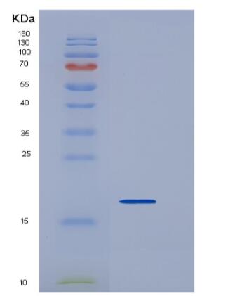 Recombinant Mouse REG3D Protein (His tag)