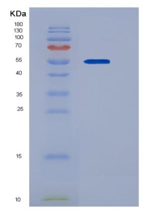 Recombinant Human ADAM15 / MDC15 Protein (His tag)