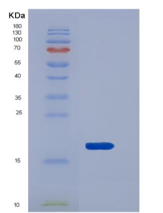 Recombinant Mouse REG3B / Pap1 Protein (His tag)