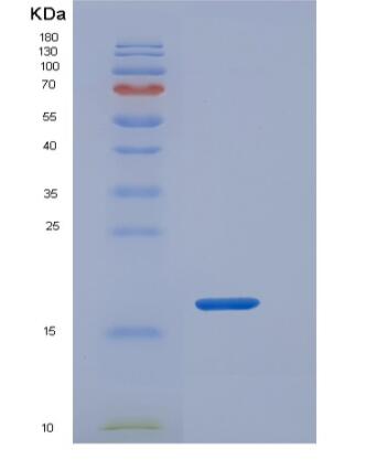 Recombinant Human REG3A / HIP Protein (His tag)