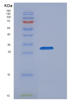 Recombinant Human OSTM1 Protein (His tag)
