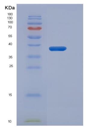 Recombinant Human MAPT / Tau Protein (His tag)