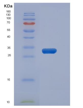 Recombinant Human MAP1D / Methionine Aminopeptidase 1D Protein (His tag)