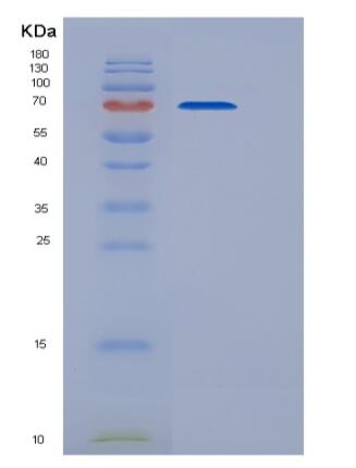 Recombinant Mouse CDCP1 Protein (His tag)