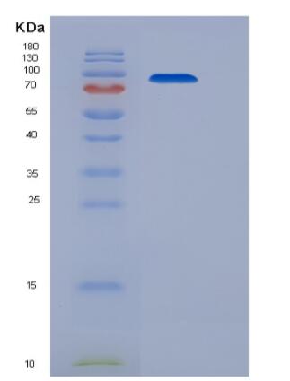 Recombinant Human AGO1 / Argonaute 1 / EIF2C1 Protein (His tag)