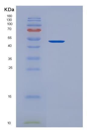 Recombinant Human METTL11A Protein (GST tag)