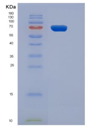 Recombinant Human CD3D & CD3E Heterodimer Protein