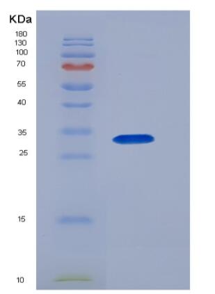 Recombinant Human CD46 Protein (His tag)