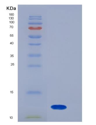 Recombinant Mouse S100A8 / CAGA Protein (His tag)