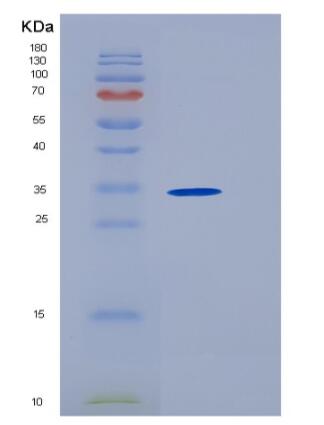 Recombinant Human Follistatin / FST Protein (His tag)