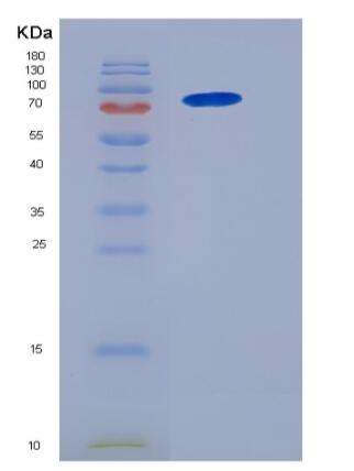 Recombinant Human NCF-2 / NCF2 / P67phox Protein (His & GST tag)