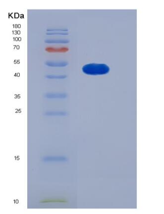 Recombinant Human SMYD2 / KMT3C Protein (His tag)