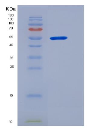 Recombinant Human PGD Protein (His Tag)