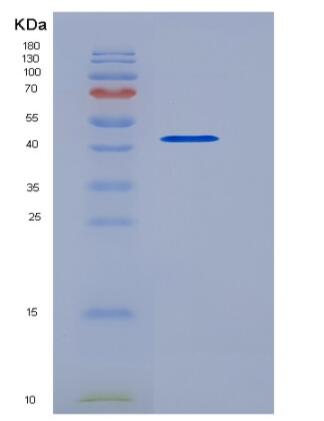 Recombinant Human CALR / Calreticulin Protein (His tag)