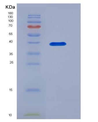 Recombinant Human DPEP2 Protein (His tag)