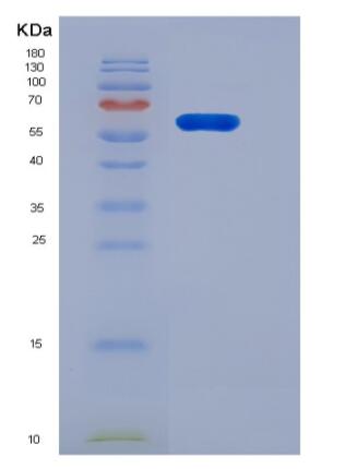 Recombinant Human PGRL / IGSF8 Protein (His tag)