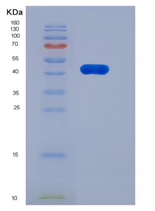 Recombinant Rat Carboxypeptidase B2 / CPB2 Protein (His Tag)